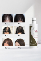 KARSEELL Anti Hair Loss Dökülme Önleyici Şampuan 500 ml - 5