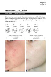KOREACO Anti-Blackheads Acne Ampoule Siyah Nokta ve Akne Ampulü - 3